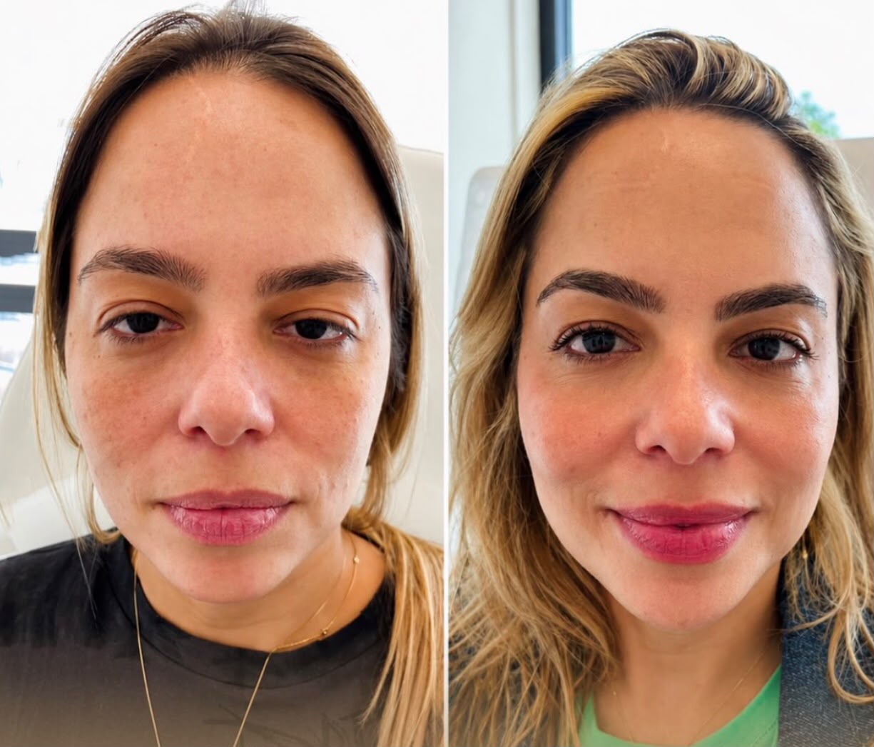 Rinotox — Dra. Fabianne Figueiredo